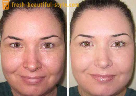 El tóner para la cara - ¿qué es y cómo se usa? Cuidado de la piel productos para el rostro