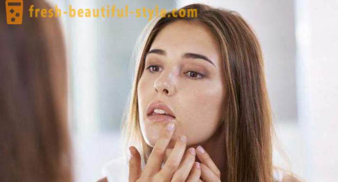 ¿Por qué muchas personas tienen granos en la cara? Causas y métodos de tratamiento