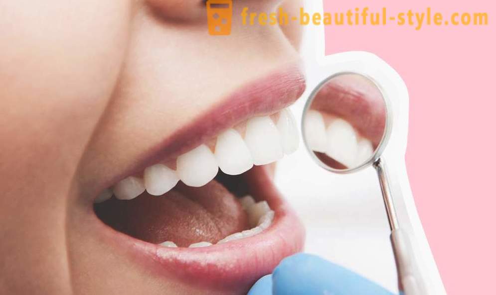 4 preguntas acerca de los implantes dentales