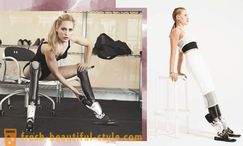 Belleza infinita: 6 modelos femeninos con prótesis