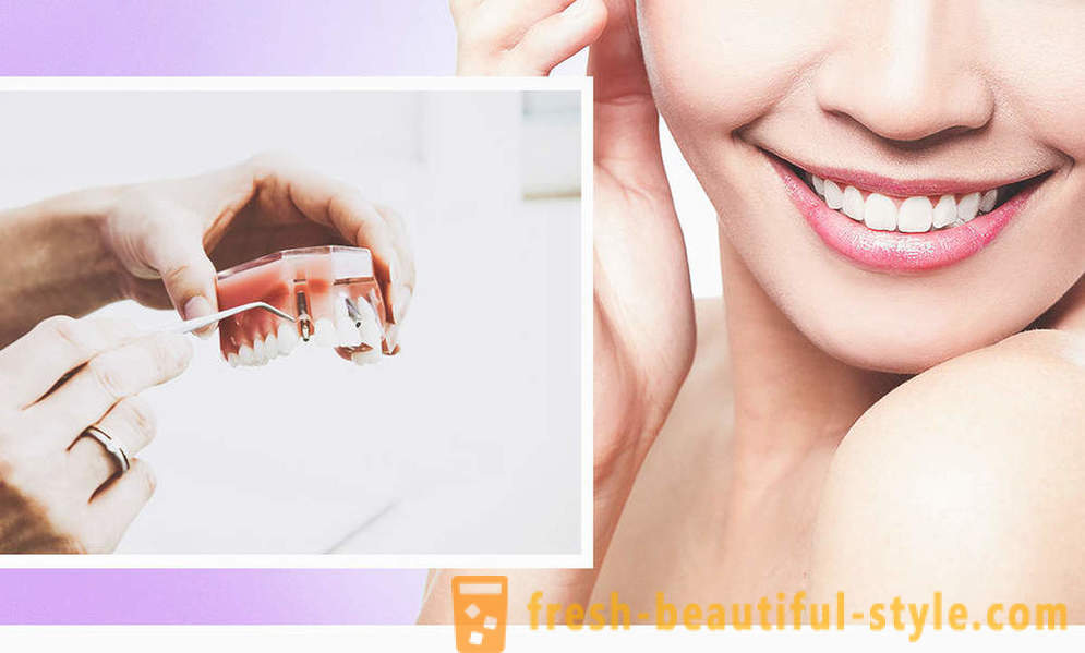 4, la forma ideal para hacer los dientes
