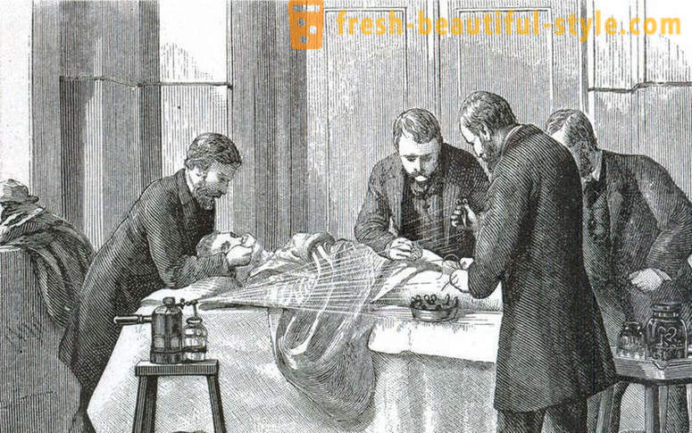 Hechos impactantes acerca de la cirugía de estilo victoriano