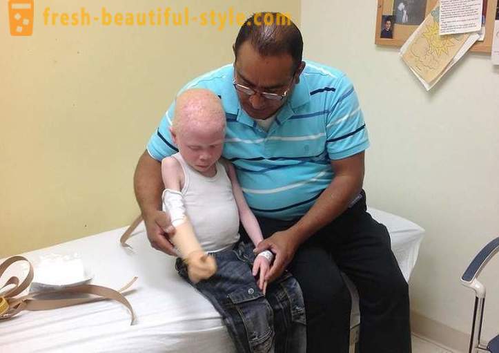 La trágica historia de Tanzania los albinos