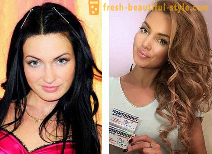 10 bellezas rusas antes y después de plástico