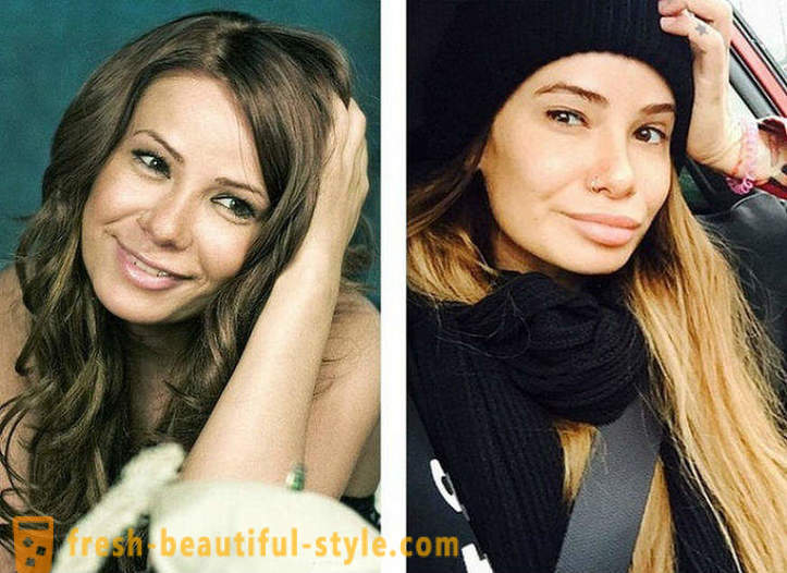 10 bellezas rusas antes y después de plástico