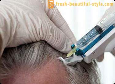 Mesoterapia para el cabello: Herramientas del maquillaje y las contraindicaciones