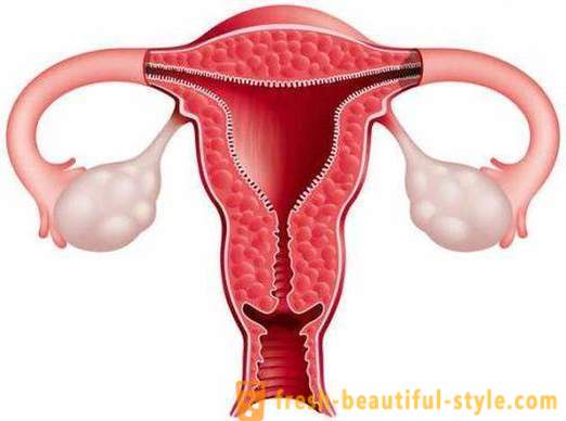 ¿Cómo aumentar el endometrio