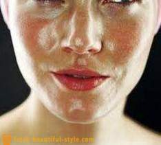 La cara la piel grasa: ¿qué hacer para lidiar con el problema?