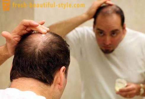 Mucho la caída del cabello. Causas y tratamiento