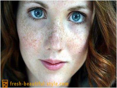 Cuidar de su belleza y la juventud: provoca la pigmentación en la cara